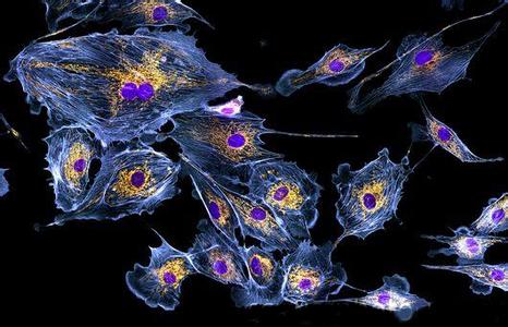 1488159611713897.jpg u=1118883156,3988347403&fm=23&gp=0.jpg