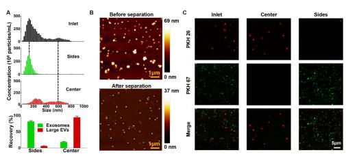 外泌體分離前后的表征 外泌體分離前后的表征