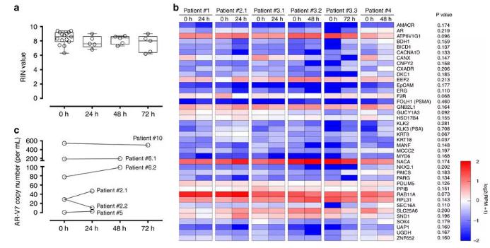 圖：從前列腺癌患者血液中分離出的CTC經(jīng)全血保存后含有完整的RNA，RNA測序和微滴數(shù)字PCR結(jié)果如圖所示。