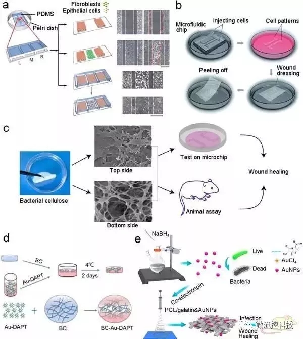 圖7.基于微流控芯片的傷口愈合模型和傷口敷料篩選。